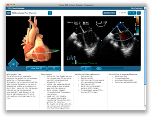 screen capture of TEE colour Doppler web page